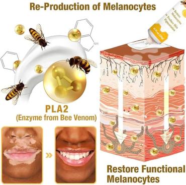 VitiGo Bee Venom Treatment Cream – Skin Repair & Regeneration Therapy