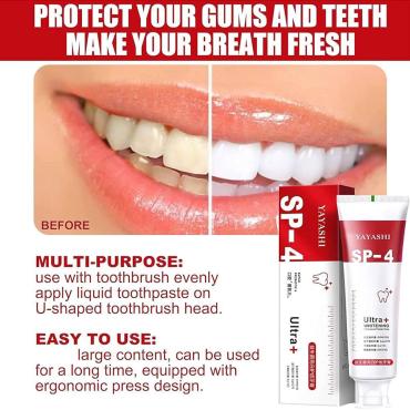 AYASHI SP-4 Professional Teeth Whitening – Fast & Gentle Smile Brightening