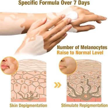 VitiGo Bee Venom Treatment Cream – Skin Repair & Regeneration Therapy